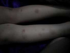 Đình chỉ cô giáo trường quốc tế đánh bé 4 tuổi tím chân