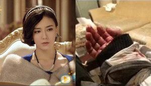 Sao nữ 'Tiếu ngạo giang hồ' cứa cổ tay tự sát vì quy tắc ngầm showbiz?