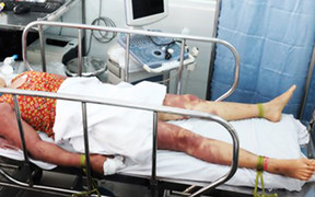 Người nhà mê tín dị đoan, mời thầy cúng dùng roi dâu đánh 2 chị em nguy kịch