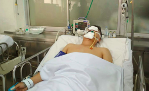 Say xỉn, nam thanh niên rồ ga tông chiến sĩ CSGT nguy kịch