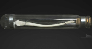 Bí hiểm ‘của quý’ của nam giới không có xương