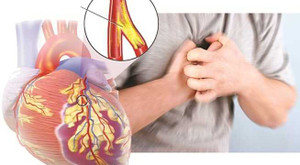 Dấu hiệu cảnh báo bệnh tim nhiều người thường bỏ qua