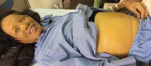 Bệnh viện K: Bệnh nhân đang mổ vẫn tỉnh táo nói chuyện với bác sĩ