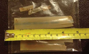 Bệnh viện bị kiện vì để quên ống nhựa hơn 20 năm trong bụng bệnh nhân