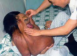 Người đàn ông mắc bệnh lạ khiến khuôn mặt chảy xệ đến bụng bị gọi là 'quái vật'