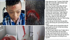 Thực hư thông tin học sinh bị bạn đánh ngất hai lần nhưng nhà trường không đưa đi cấp cứu