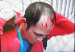 Chủ tiệm vàng giả vờ ngất xỉu, tên cướp nhận cái kết đắng