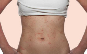 Mưa lớn kéo dài, người Sài Gòn có nguy cơ mắc nhiều loại bệnh