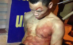 Dân vây bắt kẻ đâm thủng cổ tài xế, cướp taxi trong đêm ở Hà Nội