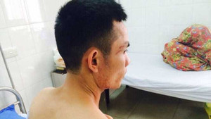 Côn đồ hành hung người bán dưa giữa ban ngày