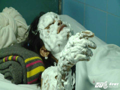 Chùm bóng bay nổ đêm trung thu, 9 người bị thương