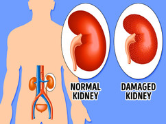 8 tác hại nguy hiểm của thuốc giảm cân bạn cần biết