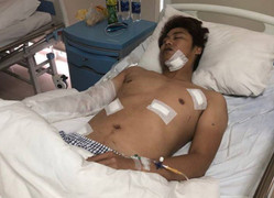 Bênh vực nữ nhân viên, giám đốc bị kẻ côn đồ xăm trổ chém trọng thương