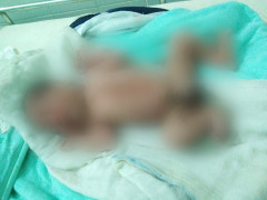 Bé trai còn nguyên dây rốn bị bỏ rơi bên bờ suối ở Quảng Trị