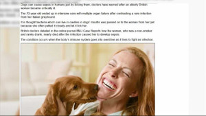 Để chó liếm mặt, một phụ nữ bị nhiễm trùng máu suýt chết