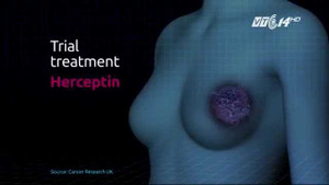 Liệu pháp mới diệt 95% tế bào ung thư chỉ trong 2 giờ