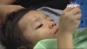 TP.HCM: Bé 4 tuổi bị mẹ đẻ và bố dượng bạo hành gãy xương đùi