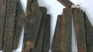 Kinh hãi phẫu thuật lấy 40 con dao trong bụng bệnh nhân