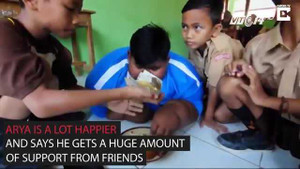 Cậu bé béo nhất thế giới nặng gần 2 tạ đã có thể đứng dậy