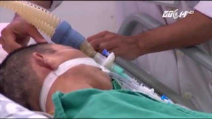 Ăn tiết canh vịt, mắc bệnh lạ tử vong sau 2 ngày