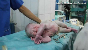 Kỳ diệu giây phút em bé ngưng tim trong bụng mẹ do trúng bom được bác sĩ hồi sinh