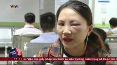 Nhầm lẫn tai hại khiến vết đốt của kiến ba khoang trở nên cực nguy hiểm