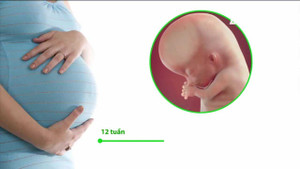 Thai phụ cần làm gì khi dịch Zika bùng phát?