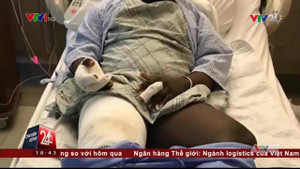 Thuốc lá điện tử phát nổ trong túi quần, người đàn ông bỏng nặng