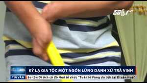 Kỳ lạ gia tộc 4 đời chỉ có 1 ngón ở Trà Vinh