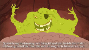 Tiến trình tế bào ung thư di căn trong cơ thể