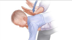 Cảnh báo trẻ nhập viện vì món ăn quen thuộc ngày Tết