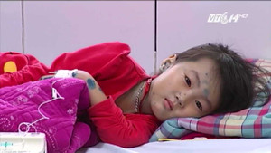 Tiêm phòng thủy đậu vẫn bị bệnh là do nguyên nhân này