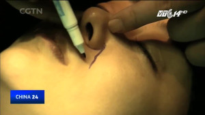 Muốn mắt to, mũi cao, nhiều phụ nữ Trung Quốc biến mình thành 'quái vật' thẩm mỹ