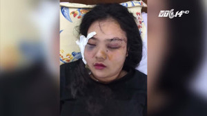 Thực hư cô gái bị truy sát, cắt tai vì tố giác người ăn cắp xe máy