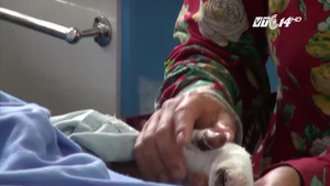 Dập nát tay do pin điện thoại phát nổ