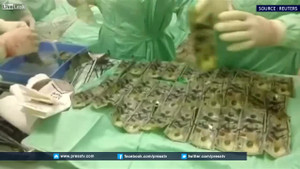 Cãi nhau với chồng, vợ nuốt gần 160 triệu đồng vào bụng