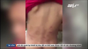 Quảng Ngãi: Dì ruột bạo hành cháu trai dã man gây phẫn nộ