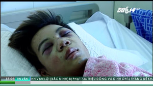 Xe Camry đâm chết 3 học sinh ở Bắc Ninh: Nạn nhân thoát chết chưa hết bàng hoàng