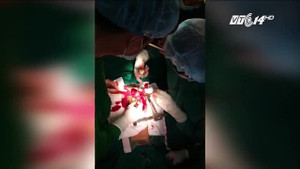 Nạn nhân bị vỡ tim do tai nạn giao thông được cứu sống thần kỳ