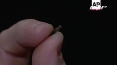 'Cấy chỉ' chữa xoang: 'Không ai có thể tùy tiện cấy chỉ cho bệnh nhân'