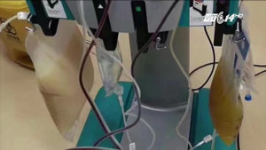 Huyết tương của bệnh nhân ăn quá nhiều thịt khiến bác sỹ hốt hoảng