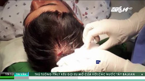 Người nhà bệnh nhân ném máy đo huyết áp, bác sỹ chảy máu đầu