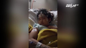 Chơi iPad suốt mùa hè, bé gái 6 tuổi bị động kinh, liệt chân tay