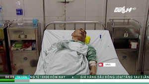 Việt Nam cứ 11 người có 1 người mắc căn bệnh có thể phải cưa chân tay