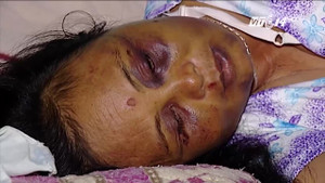 Bị đánh nhập viện vì nghi bắt cóc trẻ em: Nạn nhân có thể yêu cầu khởi tố