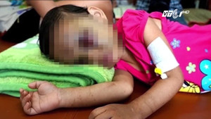 Những vụ bạo hành trẻ em chấn động khiến dư luận căm phẫn tột cùng