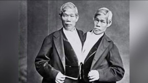 Cặp song sinh dính liền lấy vợ khác nhau, sinh 21 người con