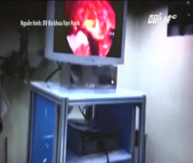 TP.HCM: Ăn uống bất cẩn, nạn nhân bị xương ếch đâm thủng ruột