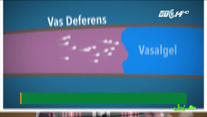 Loại thuốc giúp đàn ông tránh có con trong 2 năm