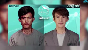 Mẹ òa khóc vì không nhận ra con trai sau phẫu thuật thẩm mỹ